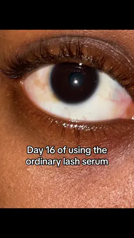 Day 16 of using the ordinary lash serum to grow my lashes #theordinary #lashserum #lashes #theordinaryskincare #fypppppppppppppppp 