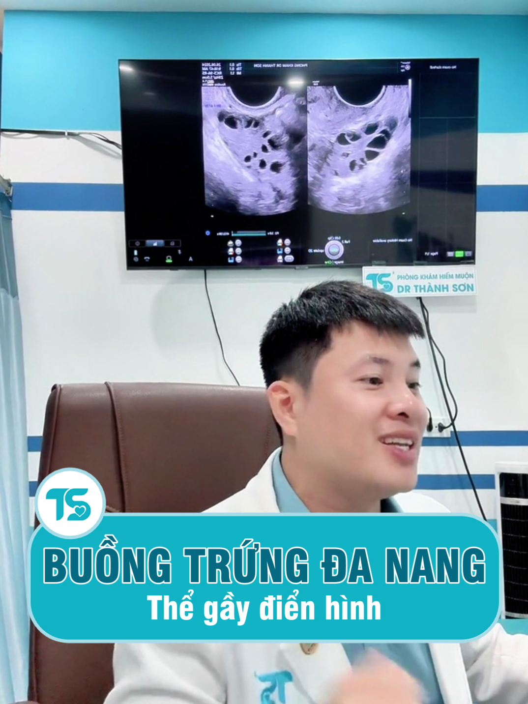 Buồng trứng đa nang thể gầy điển hình 🤔🤔 #bacsithanhson #drts #buongtrungdanang #mangthaitunhien #mongcon #suckhoe #hiemmuon #learonontiktok #fyp