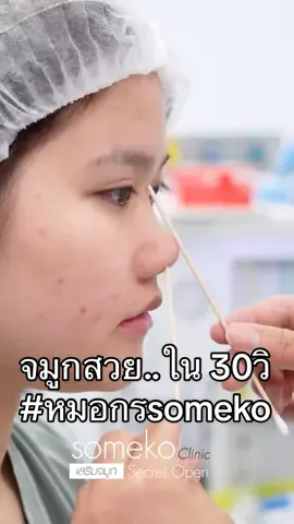 ปัญหา..จมูกใหญ่ ลูกชมพู่ แก้ไขโครงสร้างจมูกใช้ซี่โครงตัวเอง #หมอกรsomeko #สวยปังไม่พังแน่นอน #เสริมจมูกOpenSomeko #someko #somekoclinic #แก้จมูกโอเพ่น #แก้จมูกโอเพ่นซี่โครง #แแก้จมูกกระดูกซี่โครงตัวเอง #เสริมจมูกopen #เสริมจมูกโอเพ่น #ศัลยกรรมจมูก #openrhinoplasty #openreconstructuon #openrhinoplastysomeko #rhinoplastysomeko #revisionribcartilagerhinoplasty #openrhinoplastywithribcartilage #revisionrhinoplasty