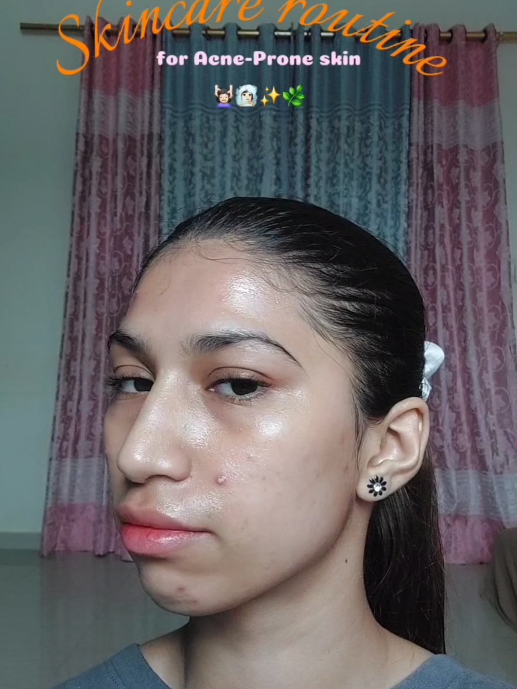 I'm not feeling my best today D.2 Manifesting glass skin -  Products used:  @BALI Tea tree toner  @SKIN1004 Official @스킨1004 Korea @skin1004 Centella Ampoule  @lululemon  Aloe vera gel 1% salicylic acid gel from Indian pharmacy  - Tags: [skincare, beauty, toner, serum, emulsion, haul, skincare routine, k-beauty, healthy skin, acne prone skin, sensitive skin , skin1004 , centella ampoule,  centella Asiatica , skin barrier] #skin1004 #glassskin #skin1004indonesia #koreanskincare #healthyskin #viral #fyp #explorepage #baliskin  #acneproneskin #acneprone #baliskin