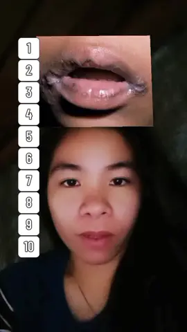 hahaha Abawwwww gid🤣😅#lipstrend #lipsfilter #fyp #fypシ 