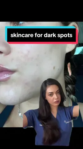 Treat melasma with sunscreen and retinoids, PIH with topical treatments, Addison's with hormone therapy, liver disease and hemochromatosis via medical management, diabetes with blood sugar control, and vitamin deficiencies with supplementation. #darkspots #darkspot #darkspottreatment #hyperpigmentation #addisonsdisease #diabetes #thyroidhealth #thyroid #foryoupage #foryou #foryourpages #fyp 