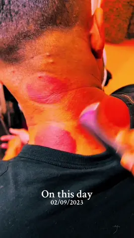 Naturally relieve next pain and tightness with our therapies #onthisday #cupping #hijama #hertscupping #neckpainrelief #grastontherapy #musclescraping #guasha #neckpain #necktension 