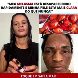 #saude 