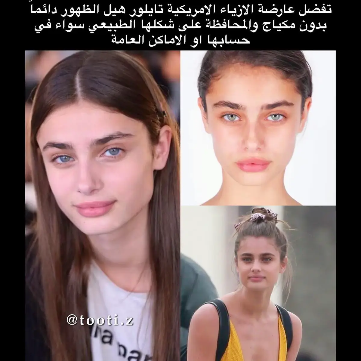 🪞🦋، جميلة جداً رغم بشرتها فيها تصبغات وحبوب لكن فضلت ما تخفيهم  #taylorhill 