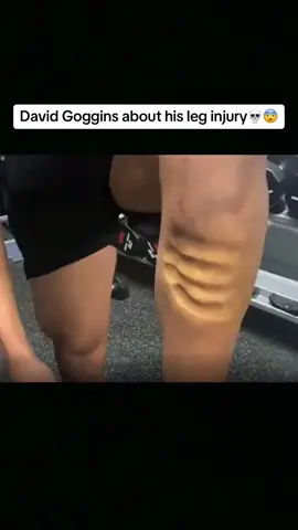 David Goggins about his legs😨💀#davidgoggins #injury #gogginsmentality #motivational #fyp#Running #discipline 