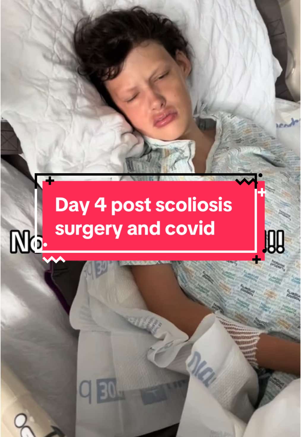 Day 4 post op Scoliosis Surgery   This was the hardest day. And now Covid🥲#scoliosis #specialneeds #specialneedsmom #epilepsy #handicap #surgerytiktok #recoveryhumor #covid  @caffeinevschaos_fostrmom 