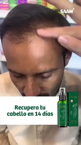 Dile a dios a la caída de tu cabello. #cabello #ouhoe #peru 