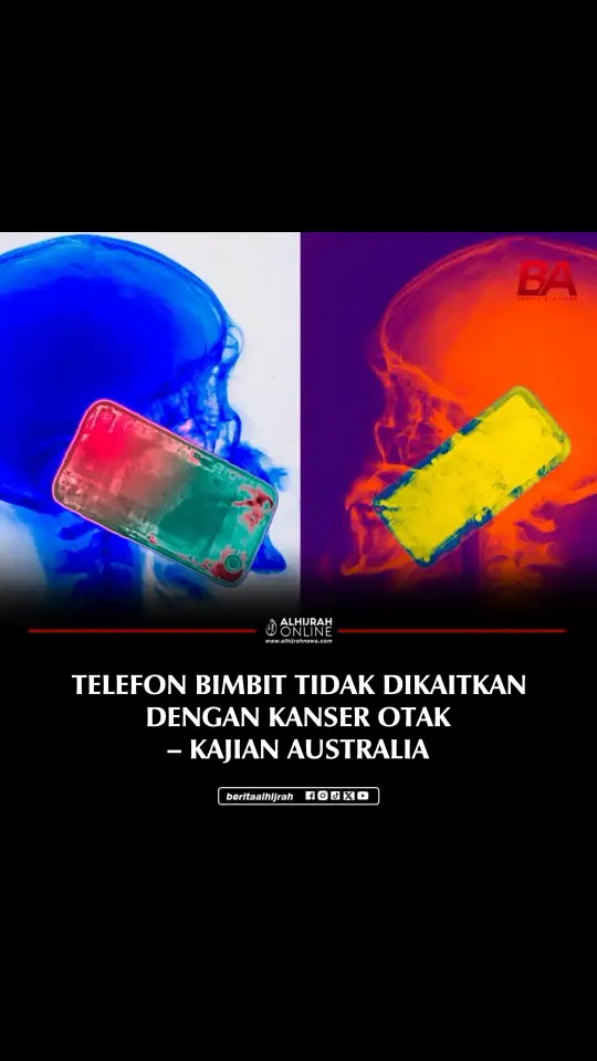 Telefon bimbit tidak dikaitkan dengan kanser otak, menurut satu kajian yang dijalankan oleh saintis Australia yang ditugaskan oleh Pertubuhan Kesihatan Sedunia (WHO), lapor Xinhua. Penyelidik dari Agensi Perlindungan Radiasi dan Keselamatan Nuklear Australia (ARPANSA) pada Rabu menerbitkan hasil kajian sistematik mengenai kesan kesihatan pendedahan gelombang radio daripada telefon bimbit. Tekan link untuk berita penuh. 