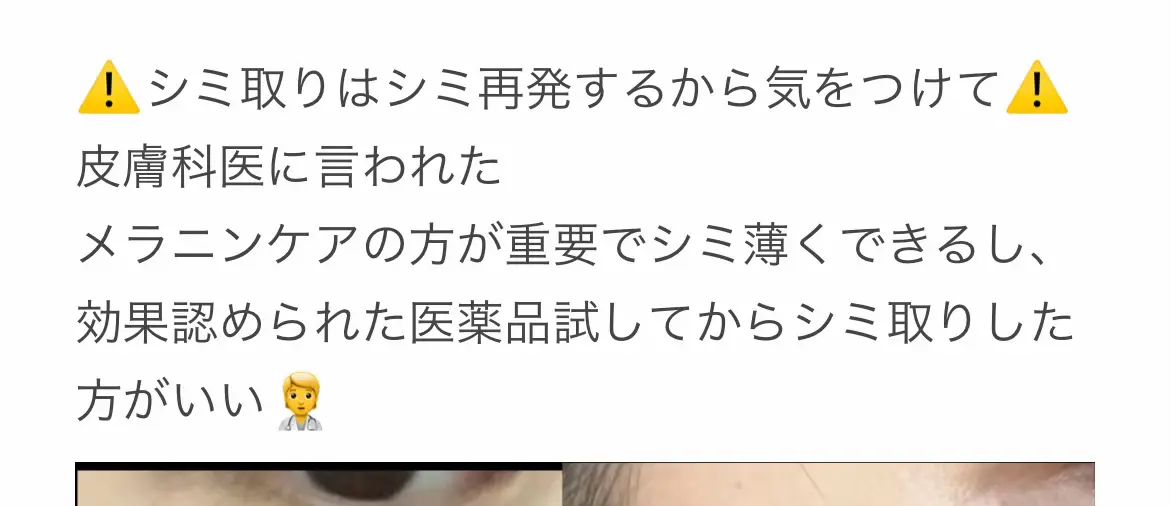 おすすめされた医薬品サプリ使ったらシミ薄くなった🥺 シミ取りしても体内のメラニンで新しいシミができちゃうんだって😭シミ取りする前に試した方がいい！ #美容 #垢抜け #シミ取り #メラニン #メラニンケア #美白 