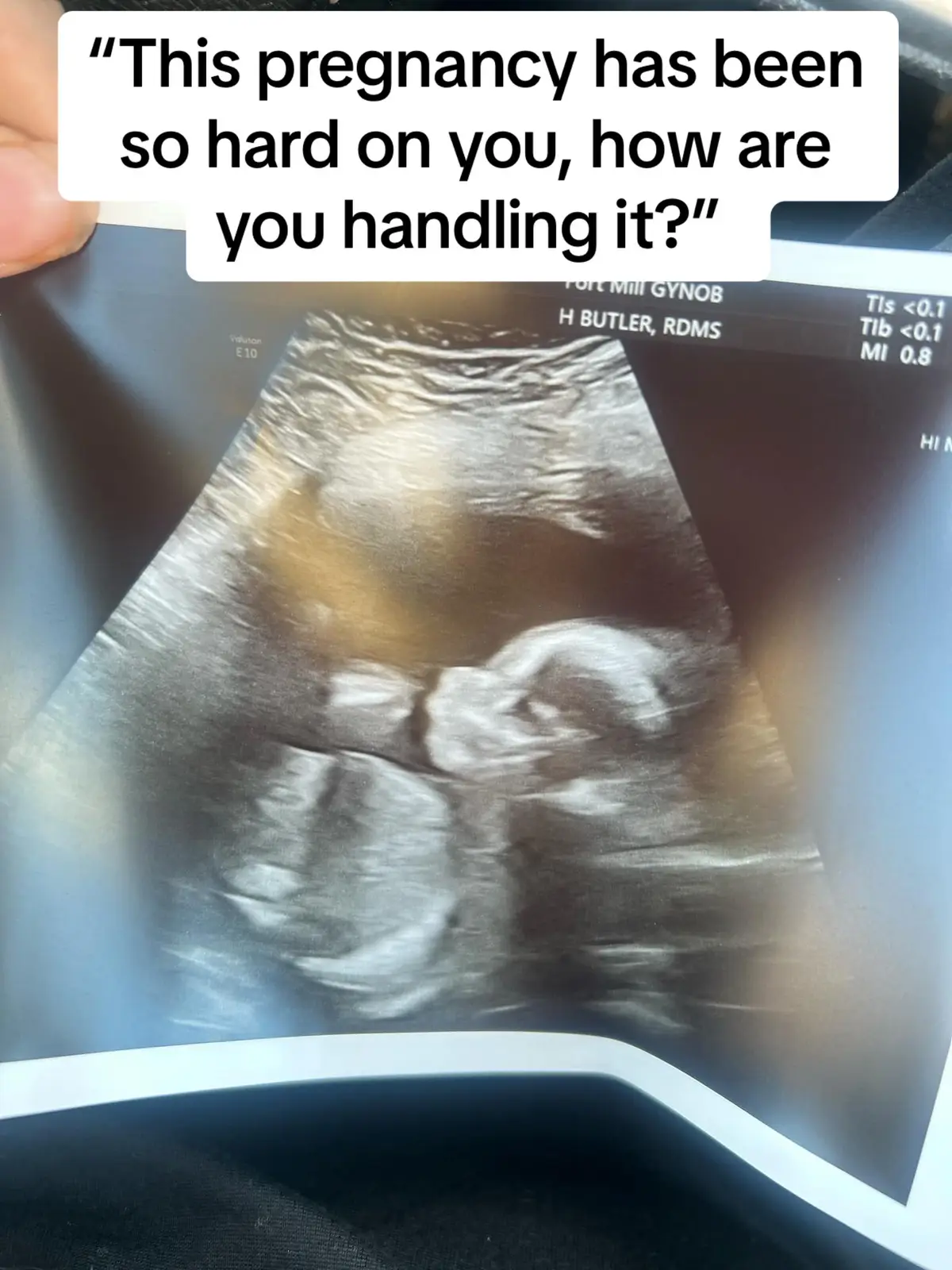 Couldnt do this without him 💛 #mylove #pregnancy #pregnancyjourney #supportivepartner #pregnancytiktok #roughpregnancy 