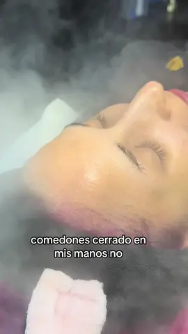 Dile adios a tu acné ✌🏼 #byeacne #facial #facialtreatment #acne #cuidadodelapiel #estetica #fyp #parati 