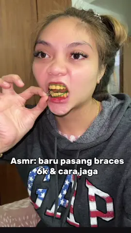 Tips jaga braces ku ..   #PurpleToothpaste #innovativedental #colorfulsmile #uniquetoothpaste  #dentalcare 
