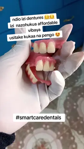PARTIAL DENTURES AT 1500
