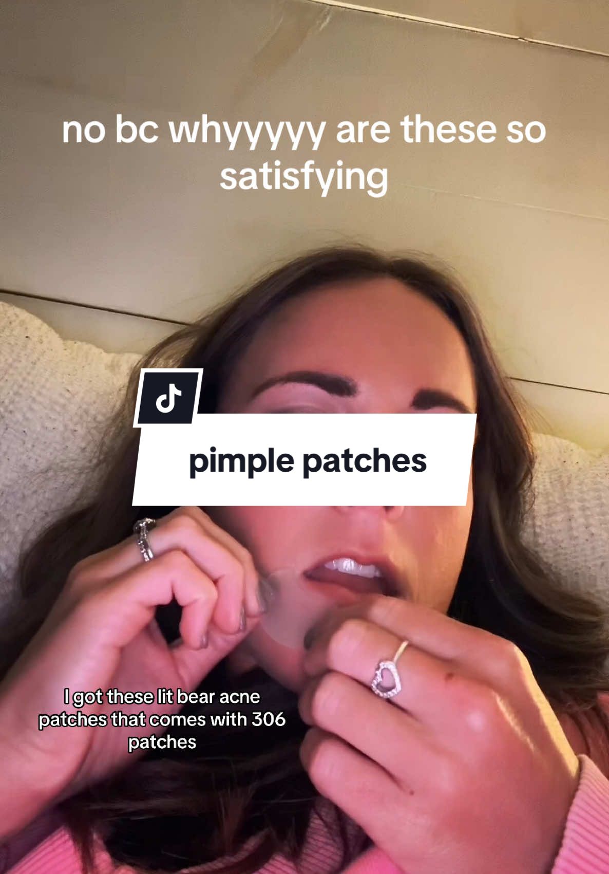 Get them now while theyre on sale!!!! Thats sooooo many patches for so cheap!!! #acne #acnetreatment #beforeandafter #skin #skincare #acnepatches #litbear #litbearpimplepatches #pimple #pimplepopper2021 