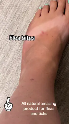 All natural flea and tick spray for your home!@BugMD @bugmdpartnership #flea #ticks #allnatural #healthy #safe #perfection #worksgood #EcoFriendly 