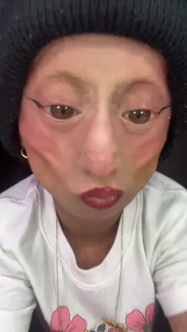 Oii😘🫶🏼🇧🇷#foryoupage #fypシ゚viral #trenddance #parati #viral #progeria 