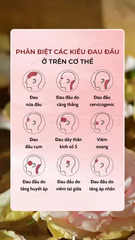 Phân biệt các kiểu đau đầu ở trên cơ thể #zoireview #xuhuong #goclamdep #beautytips #daudau 