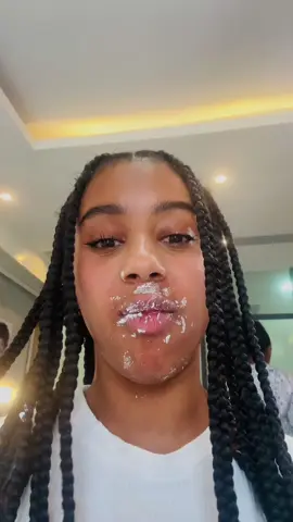 surprise suprise👀@Nathanol dental clinic #ethiopian_tik_tok #braces 