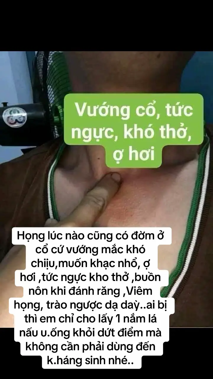 Họng lúc nào cũng có đờm ở cổ cứ vướng mắc khó chiịu,muốn khạc nhổ, ợ hơi ,tức ngực kho thở ,buồn nôn khi đánh răng ,Viêm họng, trào ngược dạ daỳ..ai bị thì em chỉ cho lấy 1 nắm lá nấu u.ống khỏi dứt điểm mà không cần phải dùng đến k.háng sinh nhé..#xuhuongtiktok #xuhuong2024 