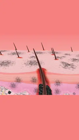 Medical Animation of Skin Clearance from Black Dots 🧑‍⚕️ #healthfield #medicaltiktok #asmr