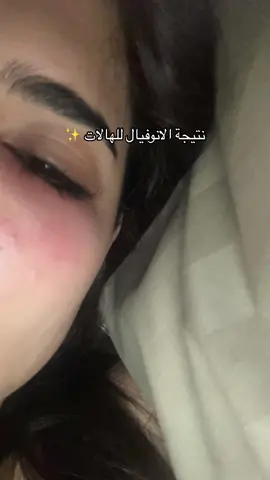 مره شفت نتايج من الانوفيال واخذت الكريم عشان احافظ على النتيجة واستفيد من المكونات بشكل اكبر تلقونه في موقع Derma city كود الخصم: fighting770 👍🏻  #viral #اكسبلور #الشعب_الصيني_ماله_حل😂😂 #هالات #عناية_بالبشرة 