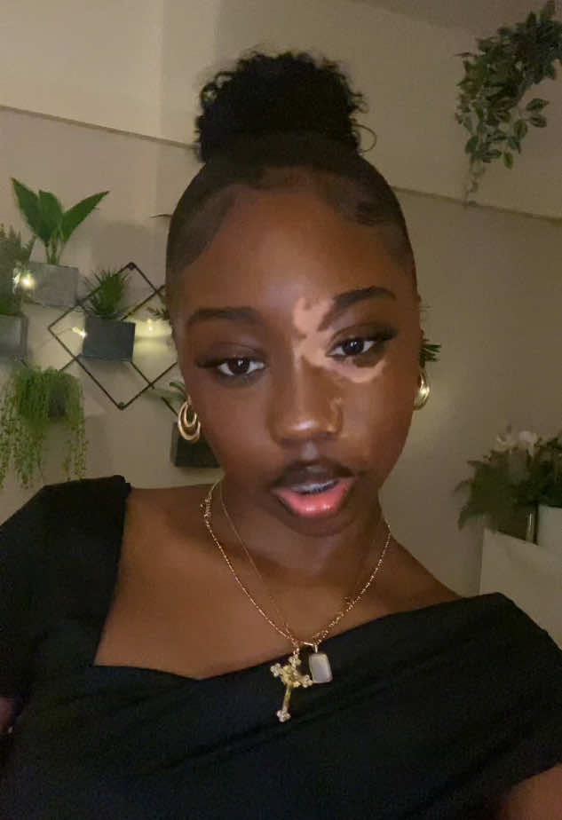 i love this songg #foryoupage #blowthisup #getmefamous #viral #fyp #vitiligo #vitiligoawareness 