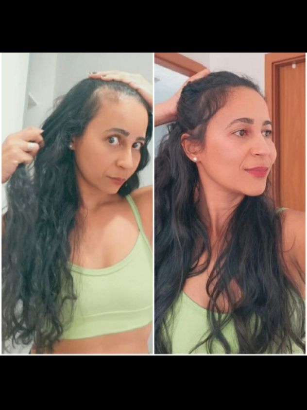 meu resultado usando o tônico poderoso por 6 meses.  preencheu minhas falhas, ajudou no combater a queda é acelerou meu crescimento. se quizer adquirir esse tônico com desconto e frete grátis só pedir nos comentários que tu te mando.  . . #viralvideo  #tiktokindia  #quedadecabelo  #crescimentocapilar  #projetorapunzel  . .