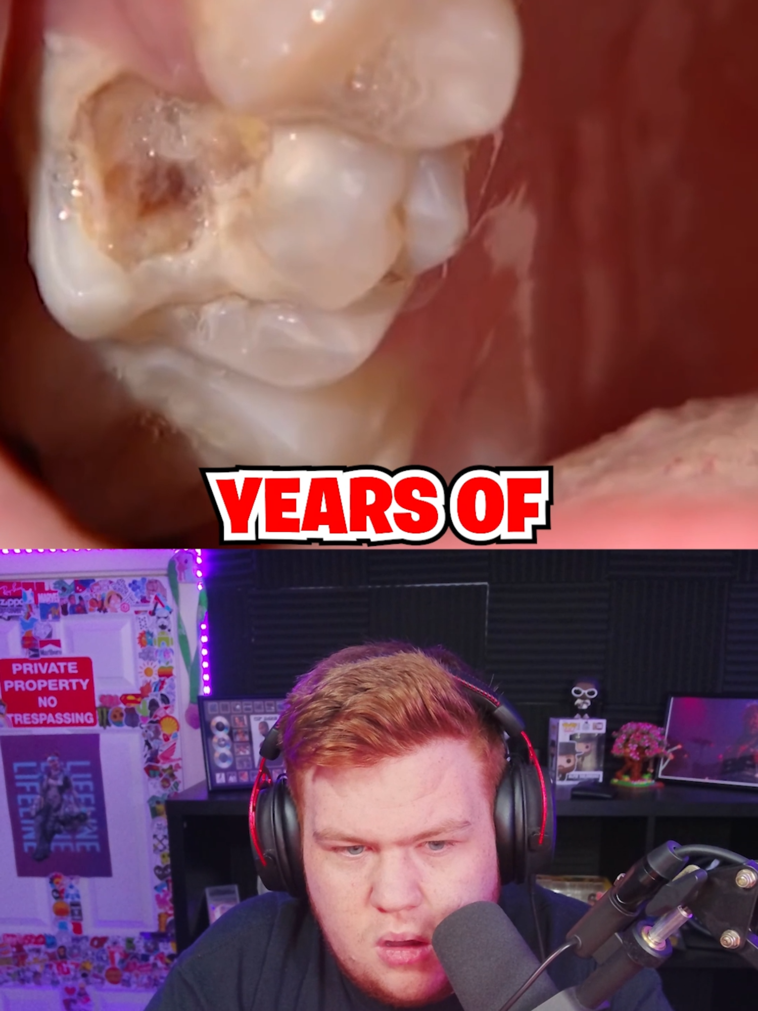 I Haven't Visited the Dentist in 20 Years #reaction #reacts #reactions #reactionboi #reactionvideo