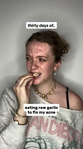 30 days of eating raw garlic to fix my acne 👀💪🏼🧄 what do you guys think? do you see a difference? I feel like my acne really went: 📈📉📈📉📈📉📈 😅  #acne #garlic #acnetreatment #skincare #skincaretips #skincarenatural #skincareroutine #skin #skinhealth #explore #clearskin #clearskintips