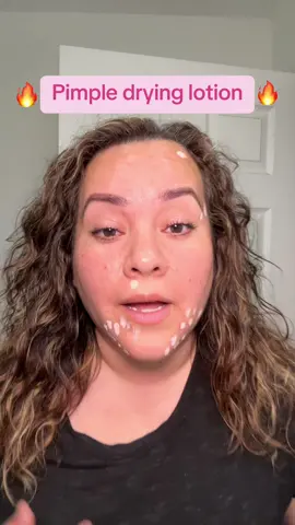I wake up with new pimples daily. It was getting very discouraging and was taking a toll on my self esteem. Thankfully, this Mario Badescu Drying Lotion came to the rescue and eases it all for me.  #mariobadescudryinglotion #acneproneskin #myskincare 