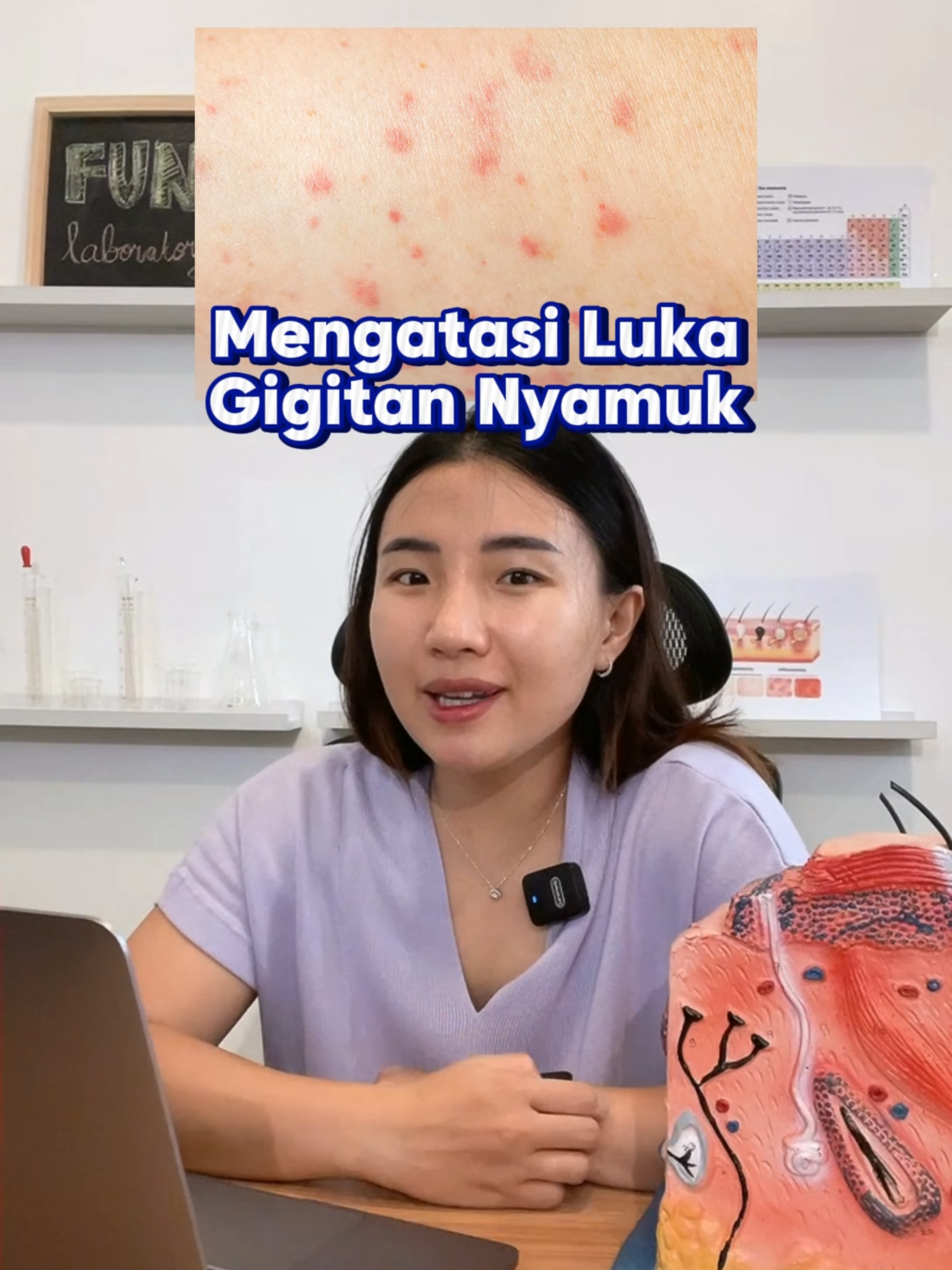 siapa disini yang kulitnya banyak luka bekas gigitan nyamuk? hmm gimana ya cara atasinya? #funskincare