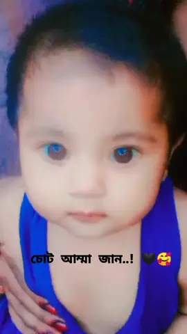 #চোট আম্মা জান.? 🖤🥰