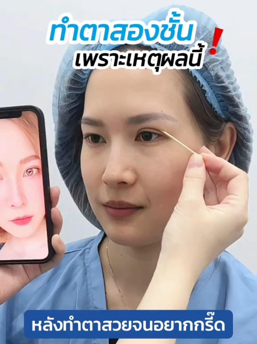 #รีวิวตาสองชั้น เบื่อติดสติกเกอร์ หลังทำสวยแทบกรี๊ด #skyclinic #หมอสกาย  #สกายคลินิก #ศัลยกรรมตา #ทําตาสองชั้น #รีวิวตาสองชั้นskyclinic #sweeteyes #ทําตาที่ไหนดี #ตาสองชั้น #รีวิวศัลยกรรม 