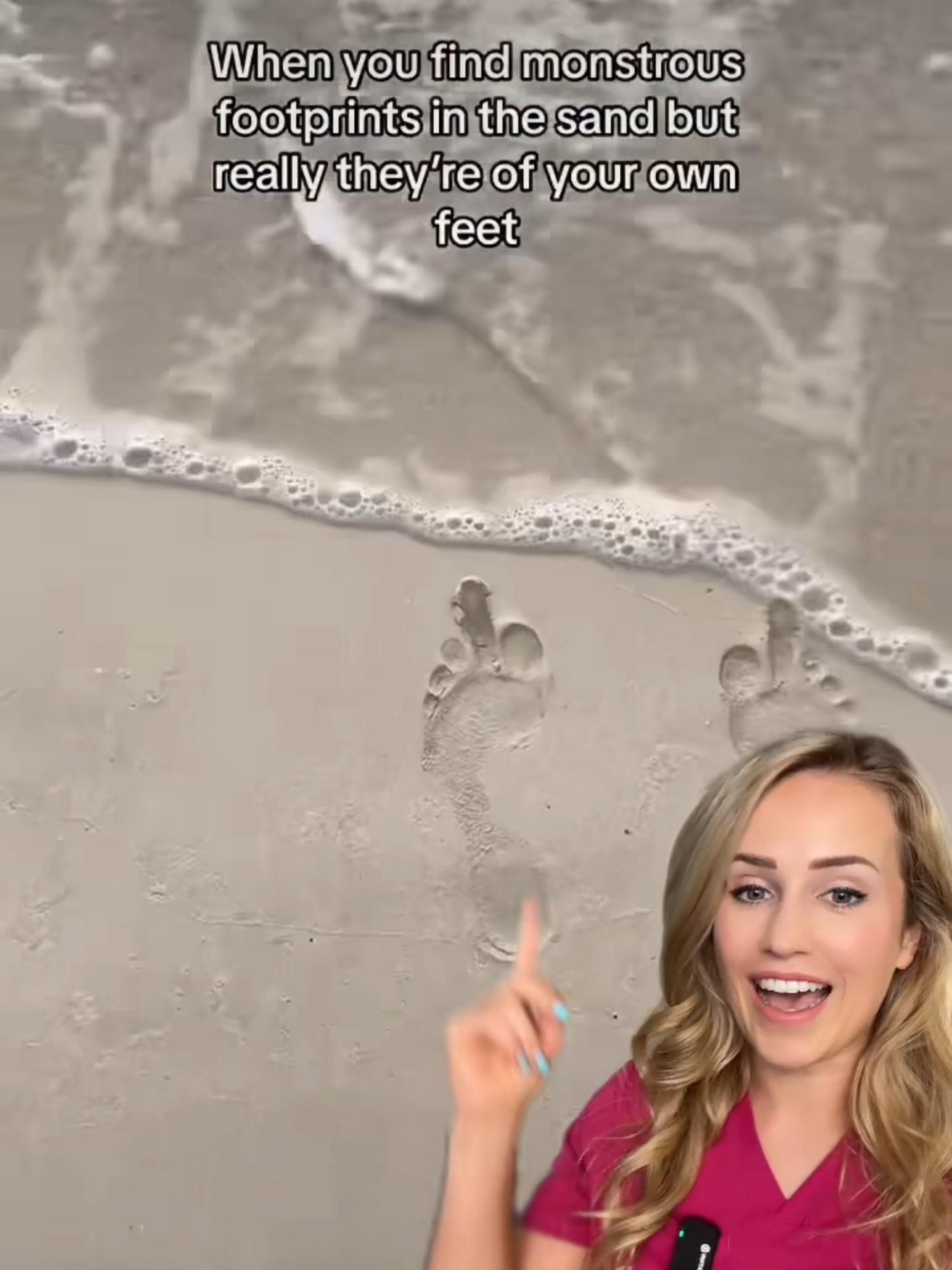 The toeprint really said ☝️ #mortonstoe #doctor #doctorreacts #footprint