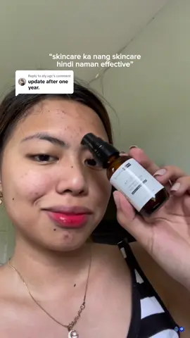 Replying to @ely.ugc Here’s an update after one year of using dermorepubliq. 🪬🧿  #fyp #dermorepubliq #acneproneskin #clearskin #niacinamide 