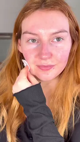 ¿Buscas tener una piel impecable✨? Este tónico exfoliante es tu salvavidas😍 🟣AHA 7 Whitehead Power Liquid🟪 ayuda a eliminar suavemente la células muertas de la piel, gracias a su contenido en ácido glicólico ✔️ ❌No contiene alcohol . 📹 @joddsmakeup . #cosrx #cosrxespaña #cosmeticacoreana #bellezacoreana #rutinacoreana #kbeauty #aha #bha #tonico #tonicoexfoliante #exfoliante #skincare #aha7 #acidoglicolico #cuidadodelapiel #pielsensible #kbeauty
