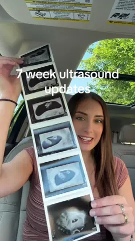*delayed post* we saw baby again today 🩷🩵🐣 my heart is exploding #ultrasound #7weekultrasound #7weekspregnant #earlypregnancy #firsttrimester #pregnancy #pregnancyafterloss #pregnancyafterinfertility #pregnancyaftermiscarriage #pregnancyjourney #pregnanttok 