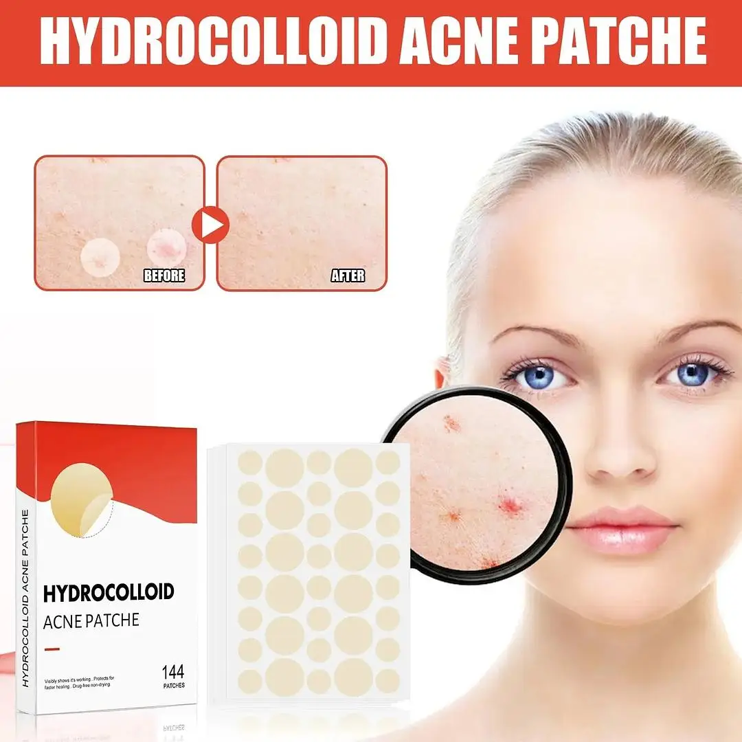 Say goodbye to pesky pimples with the Hydrocolloid Acne Patch! 🌟 These invisible and waterproof patches are a game-changer for flawless skin. Say hello to clear skin for just ฿33.56. Upgrade your skincare routine now! - Hit the link in our bio to shop now! 🛍️ #Johnnytirak #Jt #Free #Fast #Shipping