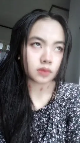 kerokan tadi pun semua menyala merah #fypage #fypシ゚viral #xyzbca 