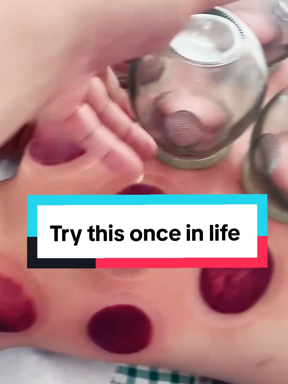 You should try at least once. #positivevibes #cupping #cuppingtherapy #viraltiktok #feeling #asmr #relaxing 