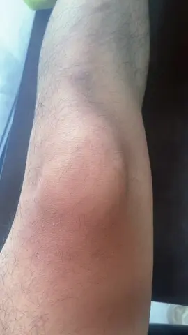 Can help massively with arthritis pain #kneepain #athritis #spotlight #footfile #electricfootfile #footcare #fyp #viral #TikTokMadeMeBuylt #tiktokshoop
