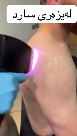 لەیزەری سارد  07377761494 #foryou #for #fyp #aesthetic #hairlaserremoval #skincare 