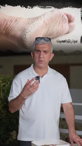 دەرمانەک بو سوتن و ئێشانا بنێ پێیا 🥇