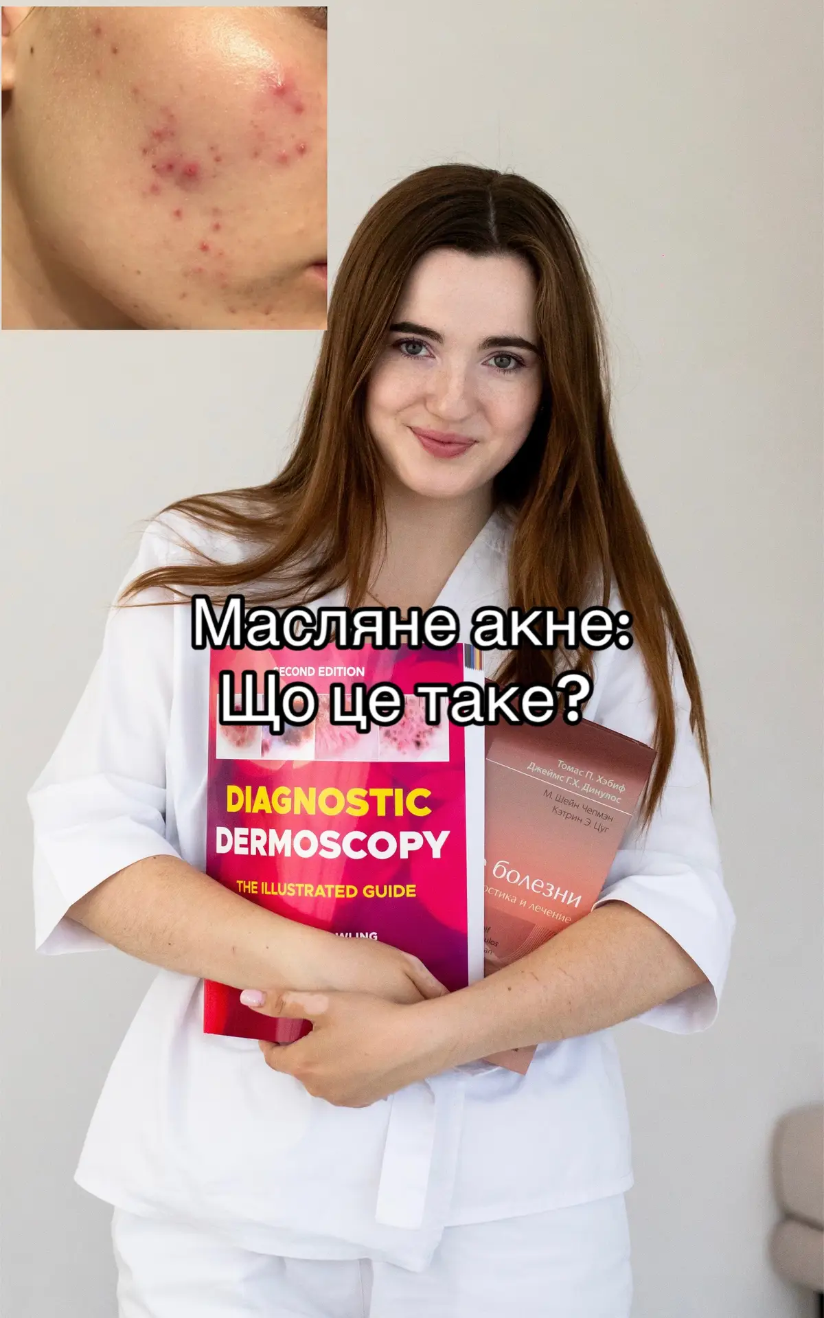 Запис на онлайн консультацію у мене в інстаграм dr.kniazieva #дерматолог   #дерматологкиїв  #дерматологукраїна #акне 