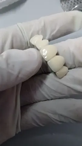 #kenya #flexibledentures #porcelainveneers #fypシ゚viral #yp #kenyantiktok #dentltechnologist #dentalcare #completedentures #teethreplacementinnairobi 
