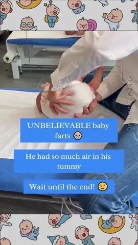 Watch as this baby finds instant relief from colic with a touch of osteopathy! A few gentle movements, and baby's gas troubles are a thing of the past. 👶🏼✨ You won't believe how quickly it works! #baby #babycute #babyfart #osteopathy #momtips 