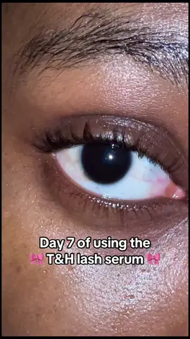 Day 7 of using the terez and honor lash serum to grow my lashes #lashserum #lashes #lashserumresults #lashgrowthserum #lashgrowth #terezandhonor #terezandhonoreyelashserum #foryou 