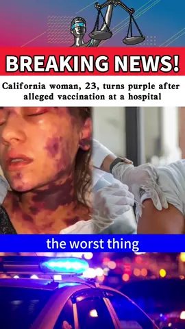 An alleged vaccination to treat a blood condition left a 23-year-old woman turning purple.#tiktok #breakingnews #fyp #foryou #news #fypppppppp 
