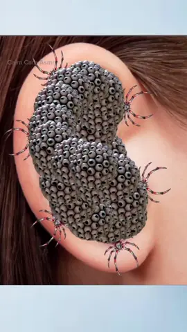 Asmr animation remove ticks and maggots treatment from ear#removing #tiktokviralvideo #WhoToFollow #calmcareasmr #skincare #animation #foryourpage #grow #satisfying #asmr #viral_video #whattowatch #removalmaggot #account #foryou 